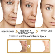 30ml Turmeric Oil Skin Dark Spot Corrector